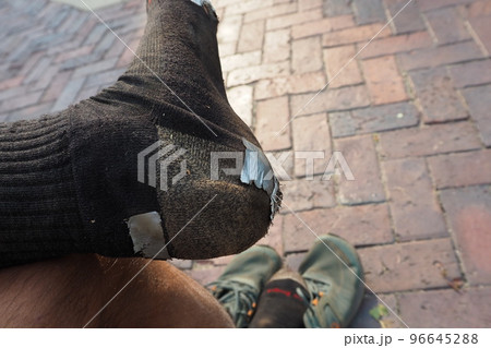 ハイキング中に破れた靴下を応急処置 96645288