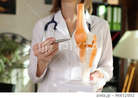 Doctor traumatologist showing ligaments and muscles on artificial model of human knee joint closeup 96652002