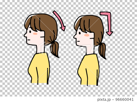 正常形狀的枕骨區和懸崖枕骨區的插圖 96660041