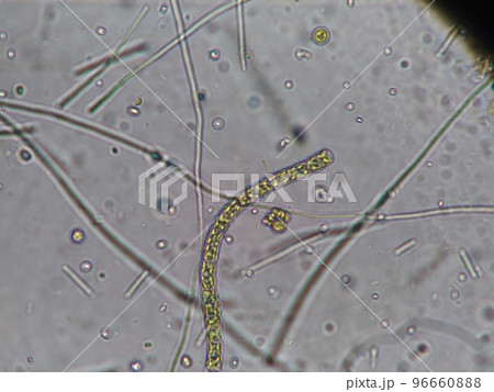 いろいろな形状をした淡水プランクトン いろいろな形状をした淡水プランクトン 96660888