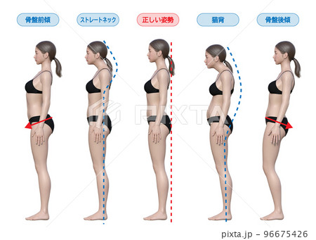 良い姿勢 悪い姿勢 猫背 ストレートネック 骨盤後傾 骨盤前傾の女性の全身横向きの3Dイラスト 96675426