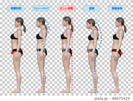 良い姿勢 悪い姿勢 猫背 ストレートネック 骨盤後傾 骨盤前傾の女性の全身横向きの3Dイラスト 96675426