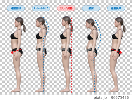 良い姿勢 悪い姿勢 猫背 ストレートネック 骨盤後傾 骨盤前傾の女性の全身横向きの3Dイラスト 96675426