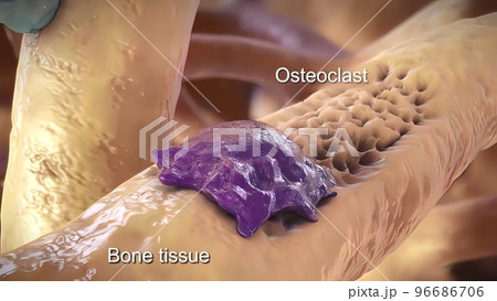 Bone tissue, osteoclast and osteoblast. while Osteoclast are large cell 96686706