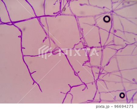 クモノスカビの菌糸がどんどん延びている様子 96694275