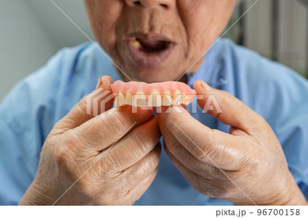 Asian senior or elderly old woman patient holding to use denture in nursing hospital ward, healthy strong medical concept 96700158