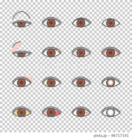 12種眼疾圖標 12種眼疾圖標 96717191