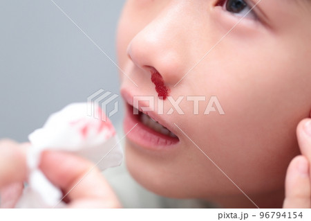 鼻血が出る小学生の女の子 (血のりでイメージ) 96794154