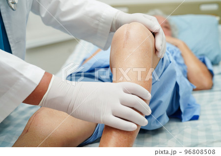 Doctor checking Asian elderly woman patient with scar knee replacement surgery in hospital. 96808508