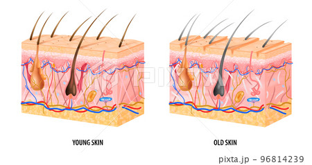 Young Old Skin Structure 96814239