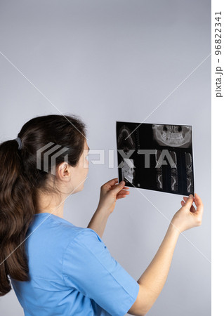 The doctor holds a CT scan of a patient with temporomandibular joint dysfunction and malocclusion. The doctor holds a CT scan of a patient with temporomandibular joint dysfunction and malocclusion. 96822341