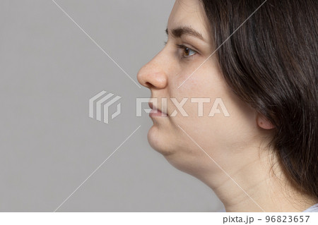 The woman has a double chin. Treatment, chin reshaping, fat removal, lifting. Place for text copy space. 96823657