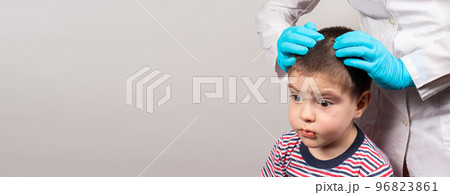 The pediatrician in the gloves will check the presence of lice and nits in a small child. Pediculosis in kindergarten, preventive examination of the head and hair. Banner copy space for text The pediatrician in the gloves will check the presence of lice and nits in a small child. Pediculosis in kindergarten, preventive examination of the head and hair. Banner copy space for text 96823861