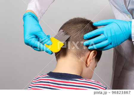 The doctor checks the presence of lice in a small child with the help of a crest. Pediculosis in kindergarten, preventive examination. Removing louse and nits from the hair. 96823867