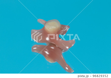 Artificial tooth prosthesis in on a blue background. Single removable prosthesis to replace a real tooth, an alternative to dental implantation in dentistry 96829352