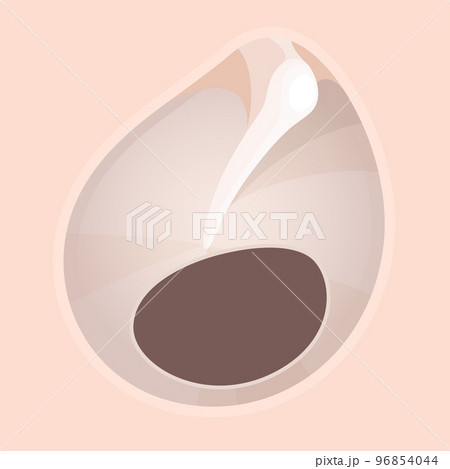 鼓膜穿孔のイラスト 96854044