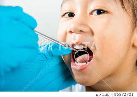 Dental kid health examination. Doctor examines oral cavity of little child uses mouth mirror to checking teeth cavity, Asian dentist making examination procedure for smiling cute little girl Dental kid health examination. Doctor examines oral cavity of little child uses mouth mirror to checking teeth cavity, Asian dentist making examination procedure for smiling cute little girl 96872701