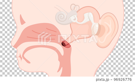 兒童咽鼓管和增大的腺樣體_矢狀面_向上圖 兒童咽鼓管和增大的腺樣體_矢狀面_向上圖 96926776