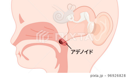 子どもの耳管と肥大したアデノイドのイラスト_矢状断_文字あり 子どもの耳管と肥大したアデノイドのイラスト_矢状断_文字あり 96926828