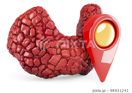 Human thyroid with map pointer, 3D rendering Human thyroid with map pointer, 3D rendering 96931241