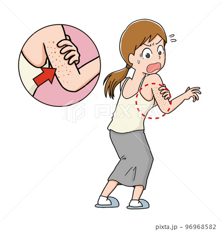 二の腕の肌荒れに驚く女性 96968582