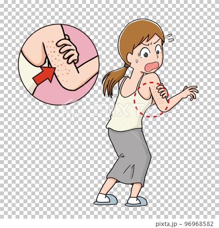 二の腕の肌荒れに驚く女性 96968582