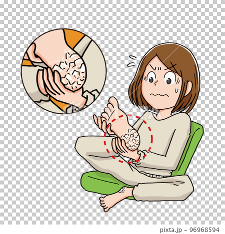かかとが荒れている女性 96968594