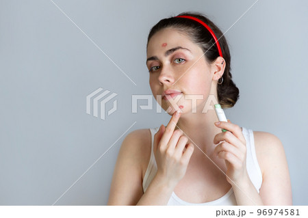 A beautiful young woman masks rashes on her face with a concealer pencil. The concept of acne, growing up and cosmetology. Copy space 96974581