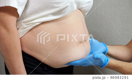 Hands of doctor in rubber gloves examine belly of patient Hands of doctor in rubber gloves examine belly of patient 96983291