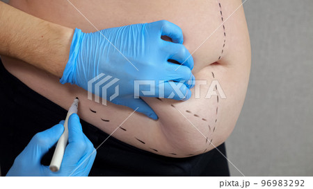 Specialist marks belly of woman standing against grey wall 96983292