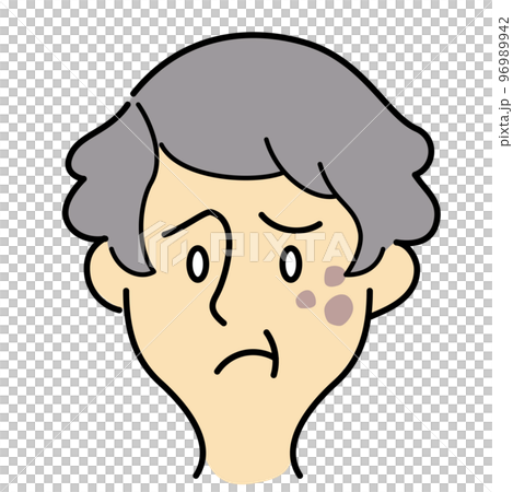 Skin troubles of elderly women with short hair Skin troubles of elderly women with short hair 96989942