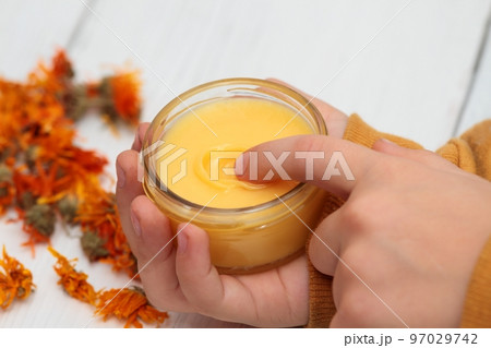 Small boy using calendula ointment 97029742