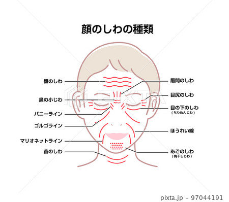 女性の顔のしわ ( 発生場所と名称 ) ベクターイラスト  97044191