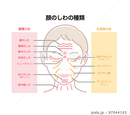 女性の顔のしわ (表情じわとたるみじわ）ベクターイラスト  97044193