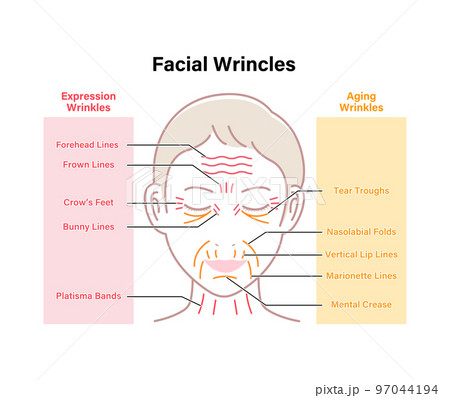 女性の顔のしわ (表情じわとたるみじわ）ベクターイラスト / 英語 97044194
