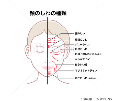 女性の顔のしわ ( 発生場所と名称 ) ベクターイラスト（しわのない顔との比較） 97044195