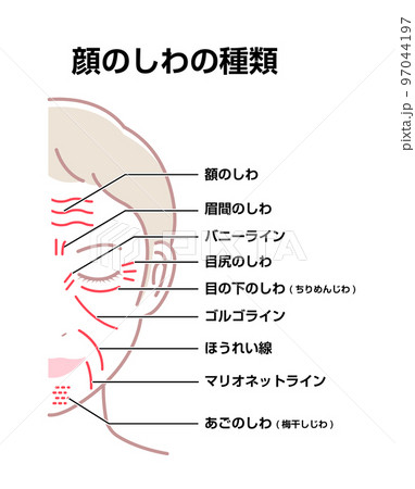 女性の顔のしわ ( 発生場所と名称 ) ベクターイラスト  97044197