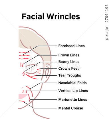 女性の顔のしわ ( 発生場所と名称 ) ベクターイラスト / 英語 97044198