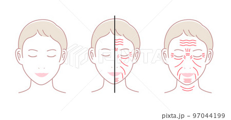 女性の顔のしわ ( 発生場所と名称 ) ベクターイラストセット/ 文字なし 97044199