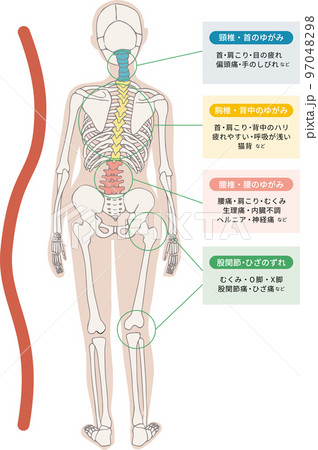 背骨・頸椎・胸椎・腰椎の歪みやずれによっておこる体の症状をイメージした図説イラスト 背骨・頸椎・胸椎・腰椎の歪みやずれによっておこる体の症状をイメージした図説イラスト 97048298