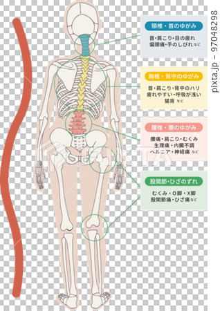 Illustrative illustrations of physical symptoms caused by distortion and misalignment of the spine, cervical spine, thoracic spine, and lumbar spine. 97048298