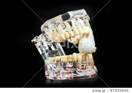 Dentist dental prosthetic teeth, gums, roots close-up. Studying dental diseases concept Dentist dental prosthetic teeth, gums, roots close-up. Studying dental diseases concept 97050646