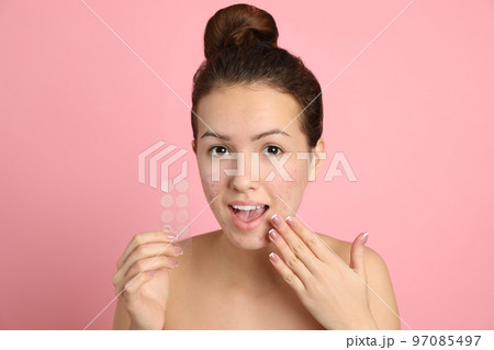 Teen girl holding acne healing patches on light pink background Teen girl holding acne healing patches on light pink background 97085497