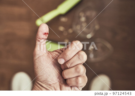 Close-up of a cut female finger on the background of a split cup and a brush with a dustpan for cleaning. A wound with blood received when cleaning broken dishes. High quality photo 97124543
