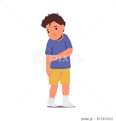 Unhappy Little Boy Scratching Body with Bleeding Pustules due Monkey Pox Disease. Kid Character with Monkeypox Virus Unhappy Little Boy Scratching Body with Bleeding Pustules due Monkey Pox Disease. Kid Character with Monkeypox Virus 97167632