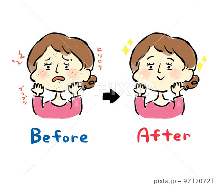 吹き出物に悩む女性の手描きイラスト素材　肌トラブル　ビフォーアフター 97170721