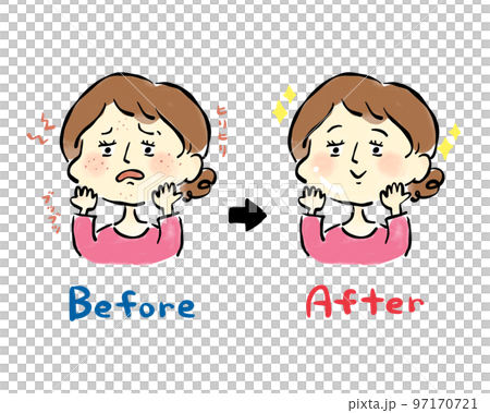 吹き出物に悩む女性の手描きイラスト素材　肌トラブル　ビフォーアフター 97170721