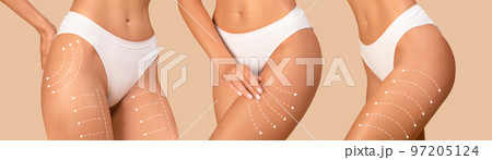 Young caucasian women in bikini with perfect skin with lines for body shaping, drainage massage 97205124