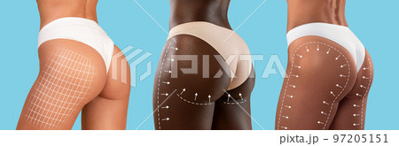 Young european, black, mixed race women in bikini with slim body with lines for figure shaping or drainage massage 97205151