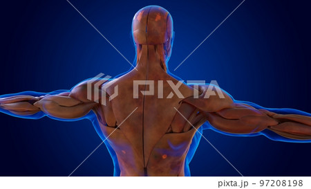 human damage muscle anatomy for medical concept 3D 97208198